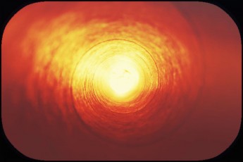 circular orange field-sun-like center