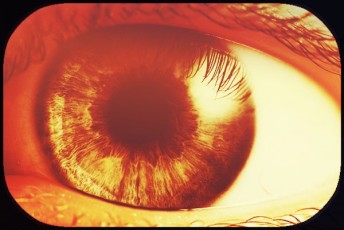 Transparency-Reveals-Content-Opportunity-Cover