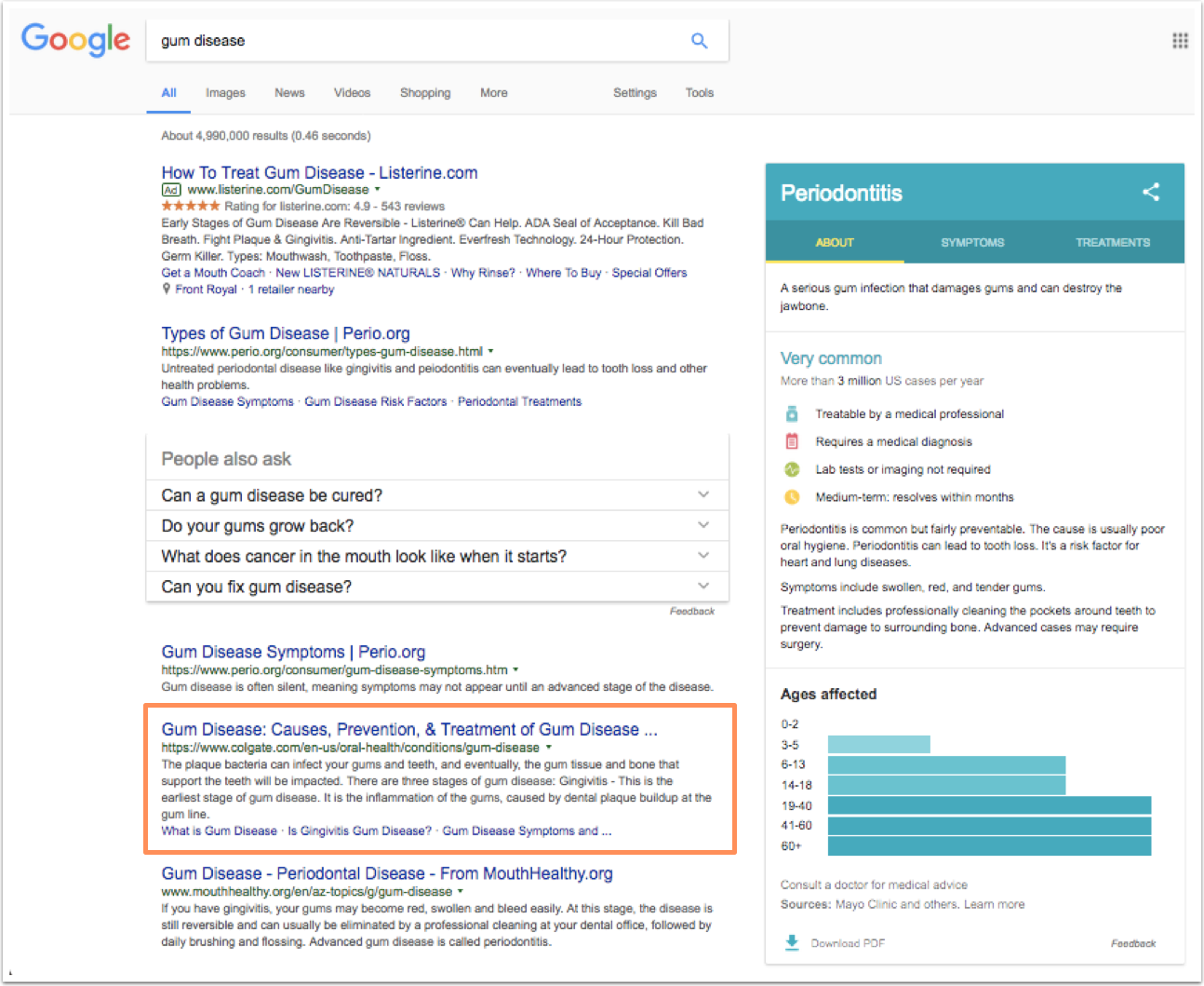 google-search-results-gum-disease